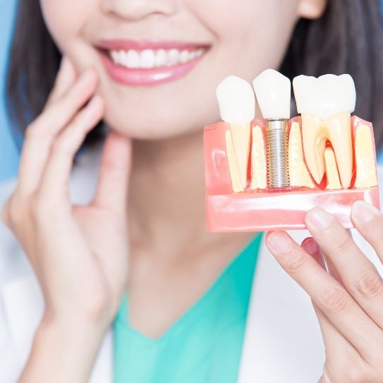 dental implants Scarborough