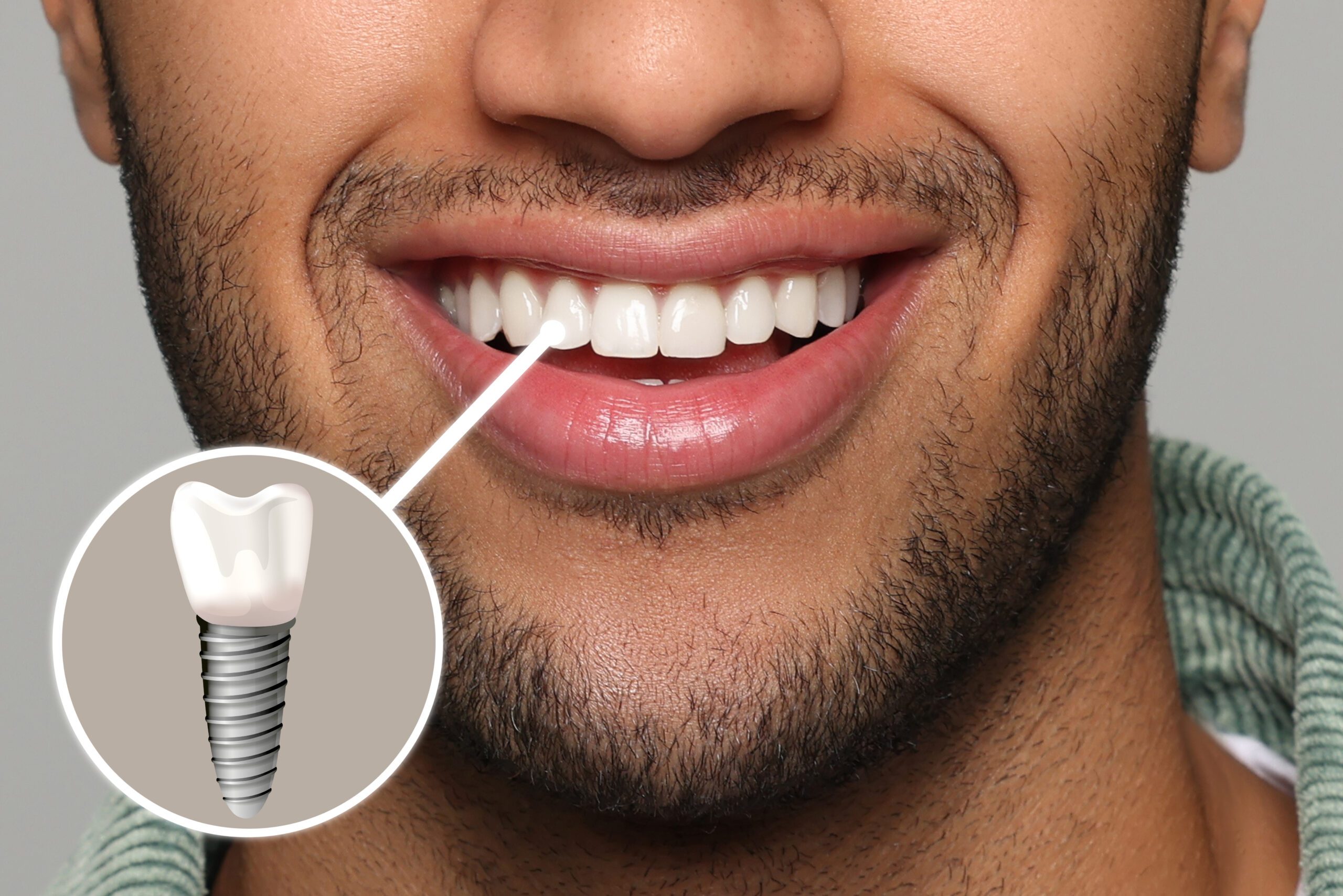 Toronto Dentists - Cliffside Dental And North Shores Dental